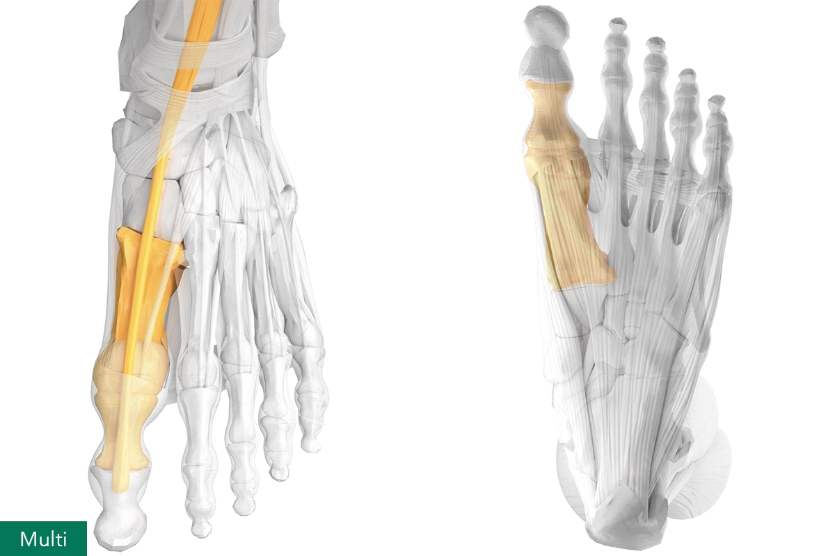 Joint and multi-complex extensor muscles of the sagittal big toe, dorsal and plantar view of the human foot.