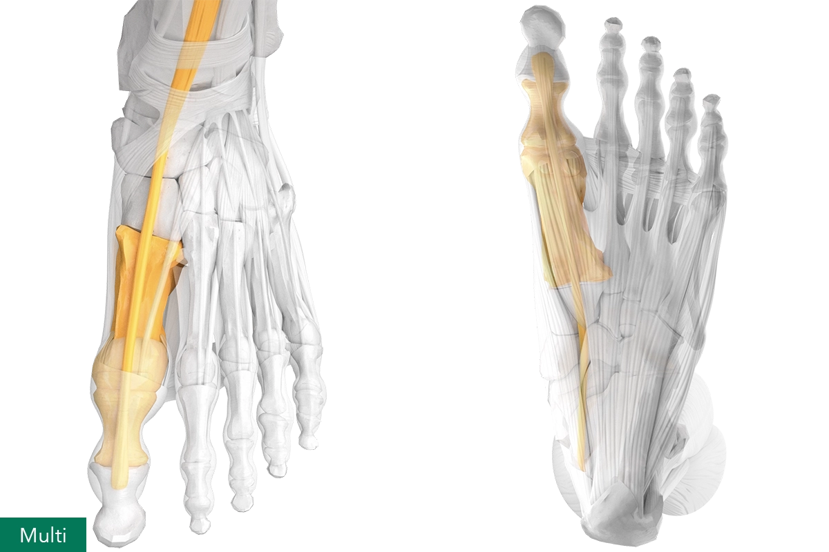 Joint and multi-complex muscles of the sagittal big toe, dorsal and plantar view of the human foot.
